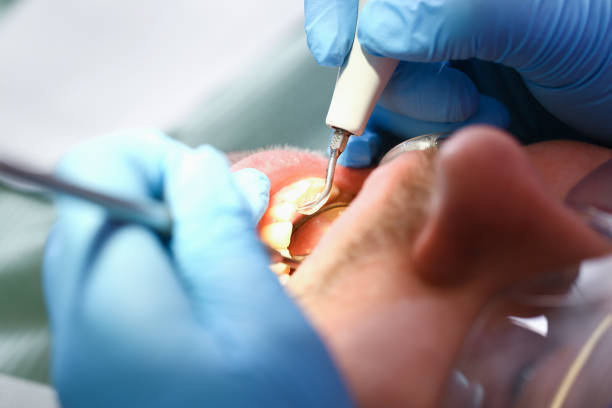 Best Tooth Infection Emergency Dentist  in Bryson City, NC
